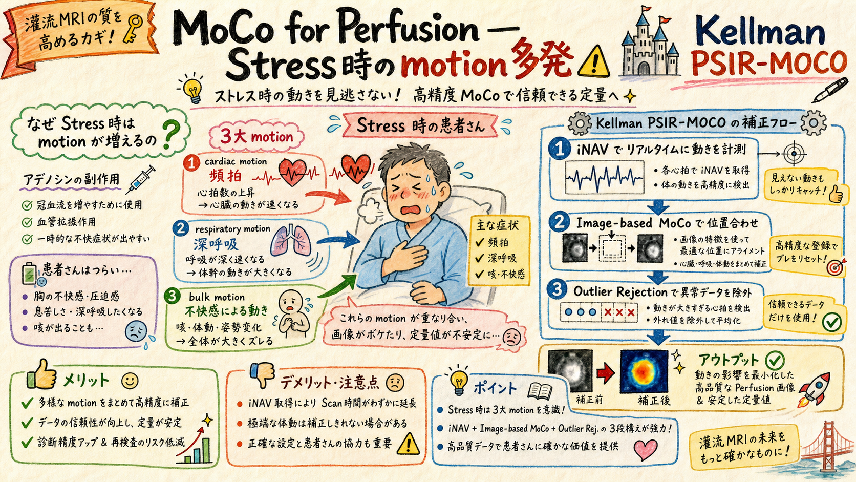 Perfusion MoCo stress